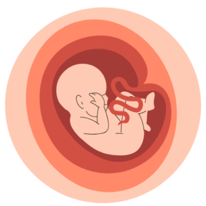 Fibroids & Ovarian Cysts